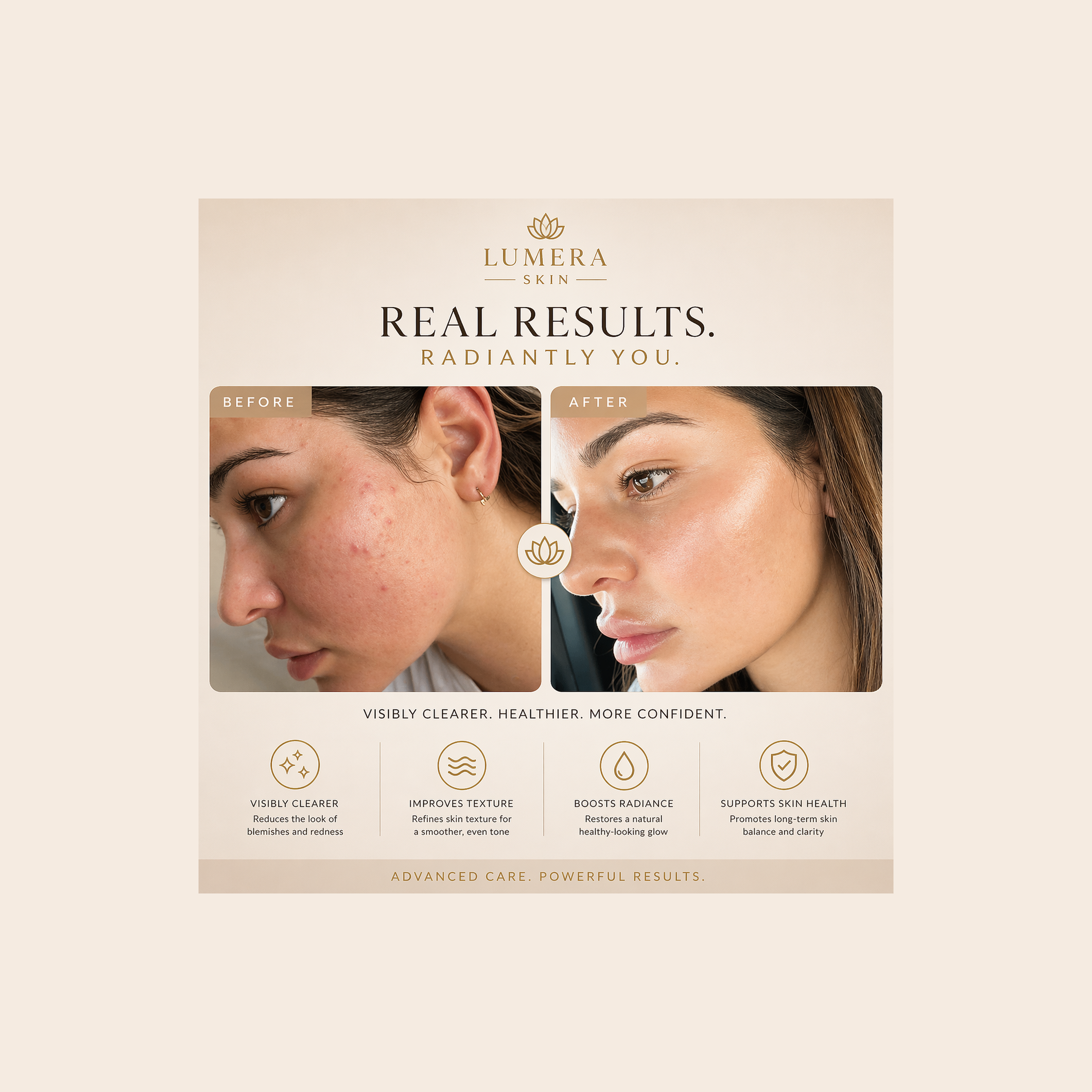 Lumera Skin™ Electrotherapy Wand